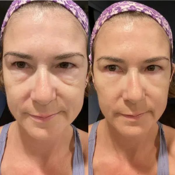 1+1 Gratis | Sofortige Lifting-Creme™ - Die Anti-Aging-Revolution für sofort straffere Haut! Online – Bild 4
