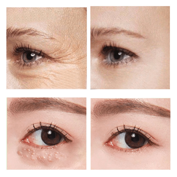 1+1 Gratis | GlowEyes™ Sofort straffende Augencreme Jetzt online – Bild 3
