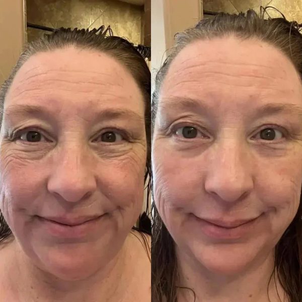 1+1 Gratis | Sofortige Lifting-Creme™ - Die Anti-Aging-Revolution für sofort straffere Haut! Online – Bild 3