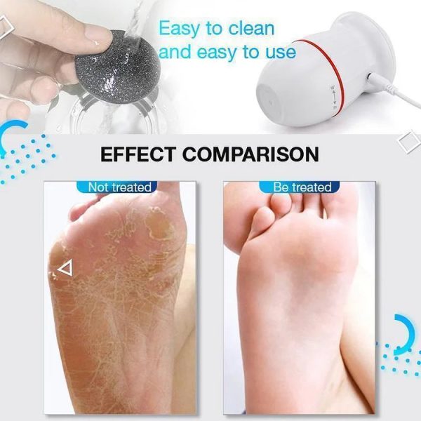 SlikFeet™ - Elektrischer Vakuum-Adsorptions-Fußschleifer Angebot – Bild 2